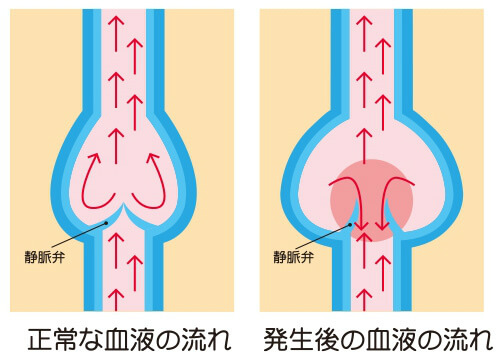 血液の流れ